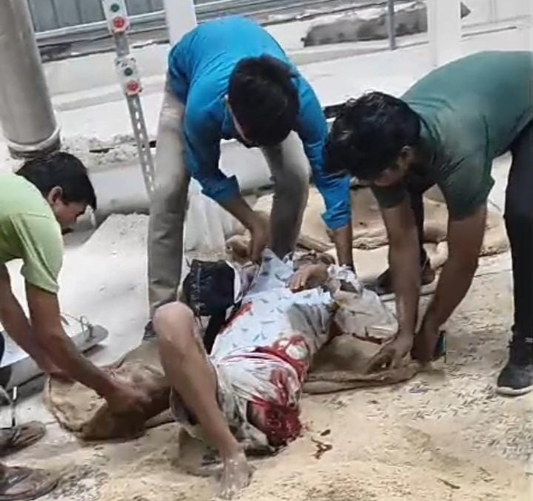 मोहासा औद्योगिक क्षेत्र के मिल में बड़ा हादसा, मशीन की चपेट में आने से कर्मचारी का कटे हाथ-पैर