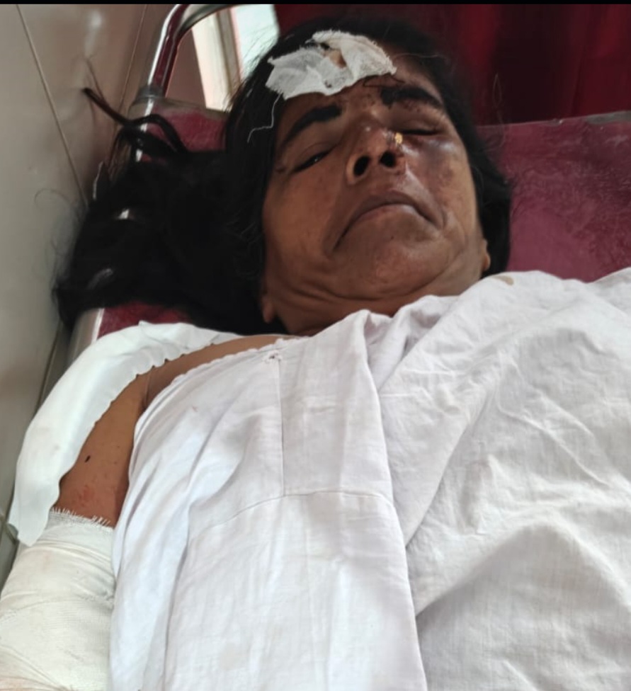 सड़क हादसे में गंभीर रूप से घायल मरीज का जिला अस्पताल में सफल ऑपरेशन, अब पूरी तरह स्वस्थ, जिला अस्पताल के आर्थोपेडिक सेक्शन के माध्यम से हुई सफल सर्जरी